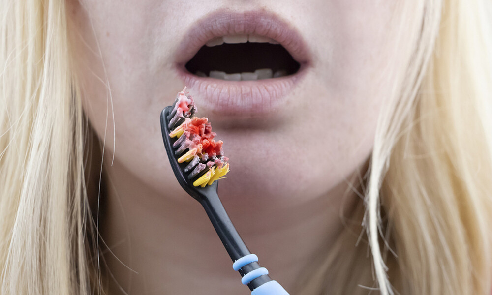 Περιοδοντίτιδα: Για ποιες θανάσιμες παθήσεις αυξάνει τον κίνδυνο (εικόνες)