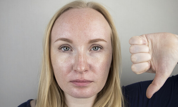 Λιπαρή επιδερμίδα: Οι παράγοντες που την επιδεινώνουν (εικόνες)