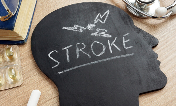 Εγκεφαλικό: Ποιες εξετάσεις περιλαμβάνει ο προληπτικός έλεγχος (εικόνες)