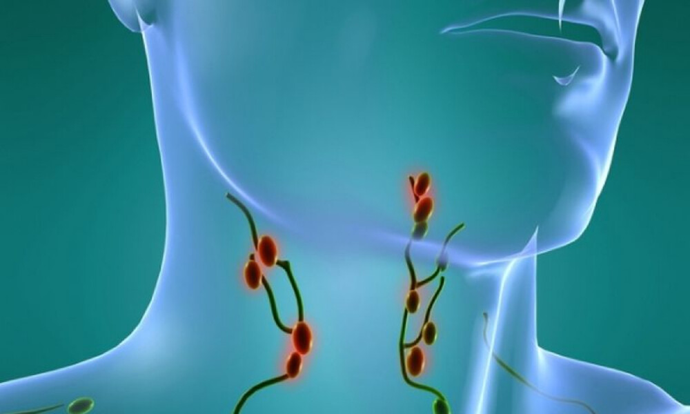 Καρκίνος στους λεμφαδένες: Αυτά είναι τα προειδοποιητικά σημάδια (εικόνες)