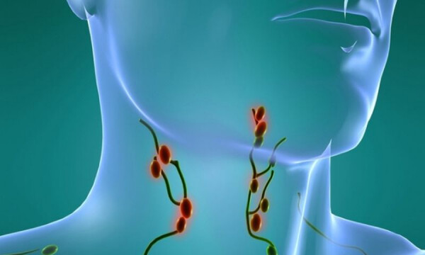 Καρκίνος στους λεμφαδένες: Αυτά είναι τα προειδοποιητικά σημάδια (εικόνες)