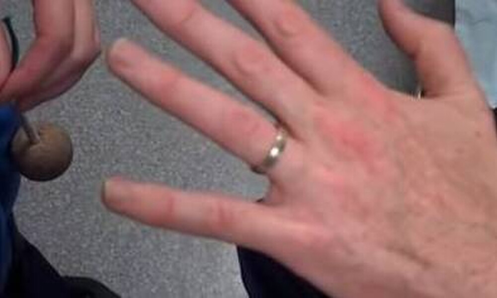 Σφήνωσε το δαχτυλίδι στο χέρι σας; Με αυτό το κόλπο θα το βγάλετε αμέσως (pics+vid)