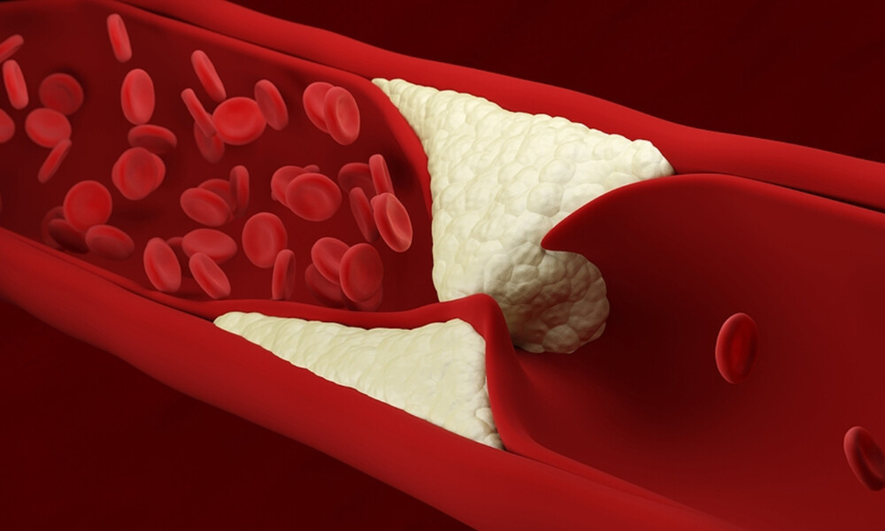 Πρόβλημα στην κυκλοφορία του αίματος: Τα ορατά σημάδια (εικόνες)