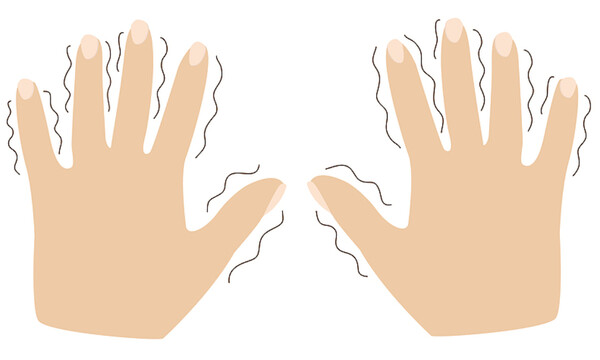 Τρέμουν τα χέρια σας; Δείτε τις πιθανές αιτίες (εικόνες)