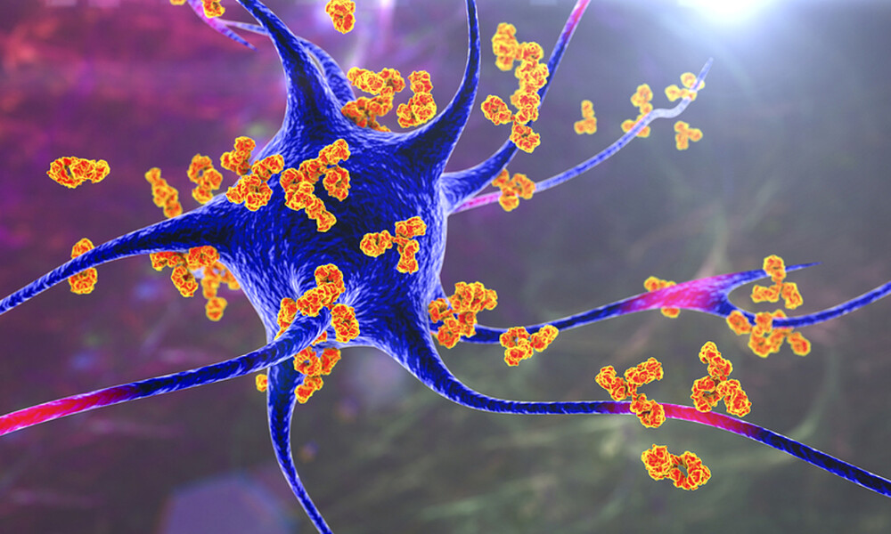 Σκλήρυνση κατά πλάκας: Οι τροφές που βοηθούν στην πρόληψη της νόσου (εικόνες)