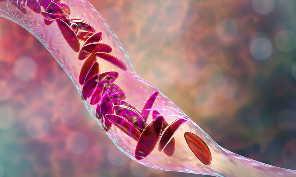 Χαμηλός αιματοκρίτης: 12 τροφές για να τον ενισχύσετε (εικόνες)