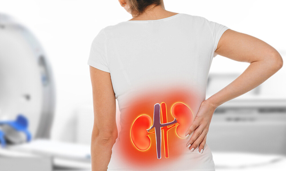 Πέτρες στα νεφρά: 7 σημεία-κλειδιά που πρέπει να γνωρίζετε (εικόνες)