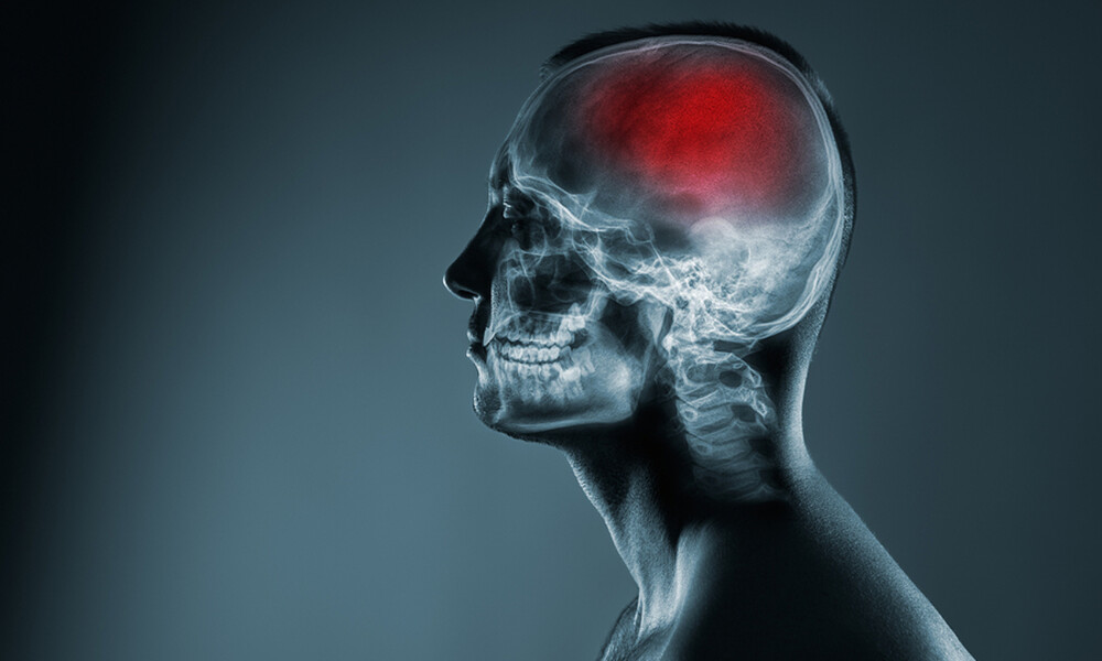 Αγγειακό εγκεφαλικό: Οι παράγοντες που πρέπει να ελέγχετε (εικόνες)