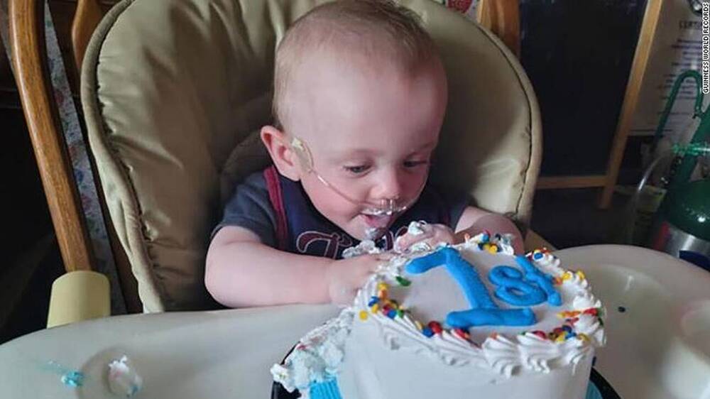 «Χωρούσε στην παλάμη μου»: Το πιο πρόωρο μωρό του κόσμου γιόρτασε τα πρώτα του γενέθλια