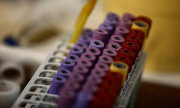 ΕΚΕΑ: Μεγάλη μείωση στα αποθέματα αίματος – Σε κίνδυνο οι ζωές πολιτών που έχουν ανάγκη από αίμα