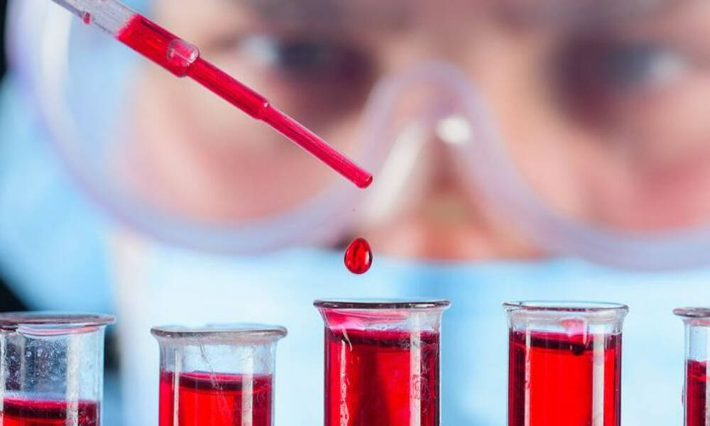 Νομίζετε ότι έχετε σχιζοφρένεια; Μια απλή εξέταση αίματος δίνει την οριστική απάντηση
