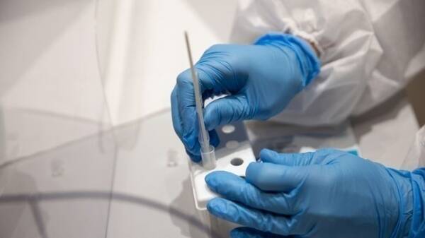 Ευλογιά των πιθήκων: Την Τρίτη φτάνουν στη χώρα τα πρώτα εμβόλια - Ποιους αφορούν