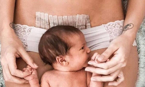Τα 9 απαγορευμένα τρόφιμα μετά από την καισαρική τομή