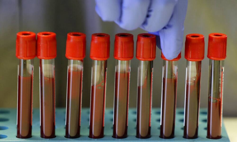 Έρχεται «κόφτης» εξετάσεων ανά ΑΜΚΑ και εξαιρέσεις στην αποζημίωση