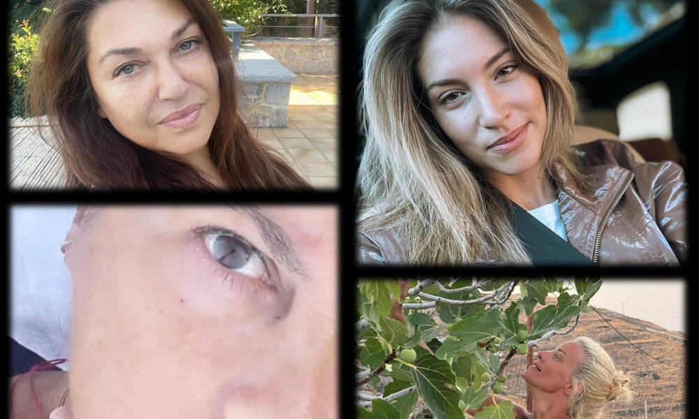 Όχι πια φίλτρα! Η... γυμνή αλήθεια των celebrities 