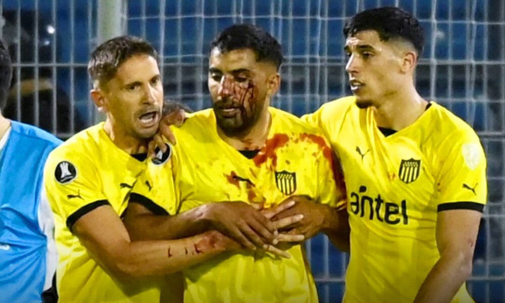 Χάος στο Copa Libertadores: Παίκτης της Πενιαρόλ δέχθηκε πέτρα στο πρόσωπο - Σκληρές εικόνες
