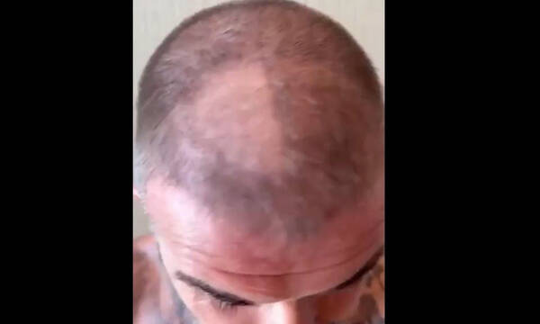 To… ατύχημα του Μπέκαμ στο κούρεμα και το δούλεμα της Βικτόρια