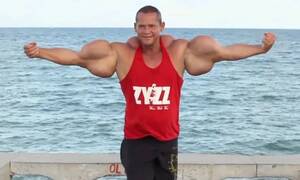 Πέθανε ο «Ποπάι» της Βραζιλίας, με τα μπράτσα μεγαλύτερα από το κεφάλι του