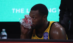 AEK: Πρόβλημα με Γκρέι στην «Ένωση» - Υπέστη κάκωση κάτω από το μάτι